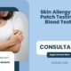 Skin-Allergy-Test-Patch-Testing-Vs-Blood-Testing