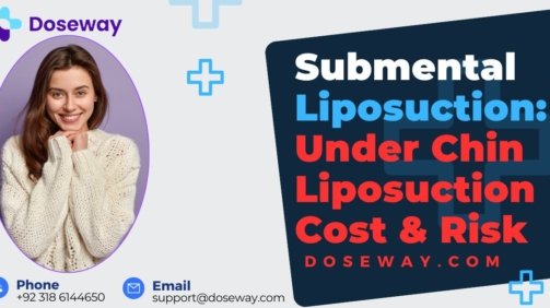 Submental-Liposuction