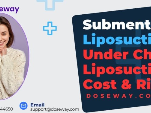 Submental-Liposuction