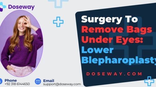 Surgery-To-Remove-Bags-Under-Eyes