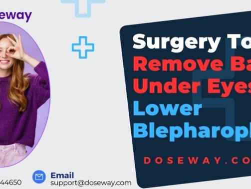 Surgery-To-Remove-Bags-Under-Eyes