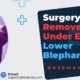 Surgery-To-Remove-Bags-Under-Eyes