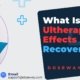 Ultherapy-Side-Effects-And-Recovery-Time