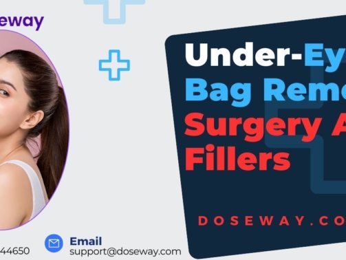 Under-Eye-Bag-Removal