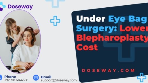 Under-Eye-Bag-Surgery