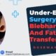 Under-Eye-Surgery