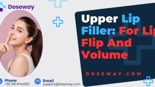 Upper-Lip-Filler