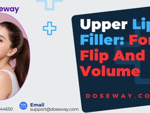 Upper-Lip-Filler