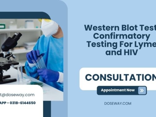 Western-Blot-Test-Confirmatory-Testing-For-Lyme-and-HIV