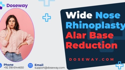Wide-Nose-Rhinoplasty