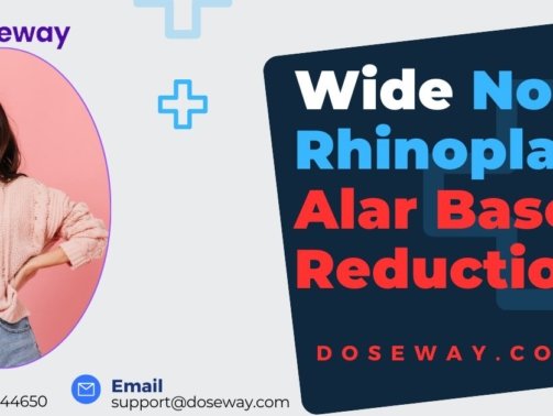 Wide-Nose-Rhinoplasty