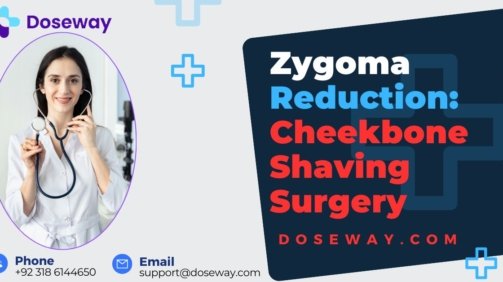 Zygoma-Reduction
