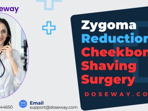 Zygoma-Reduction