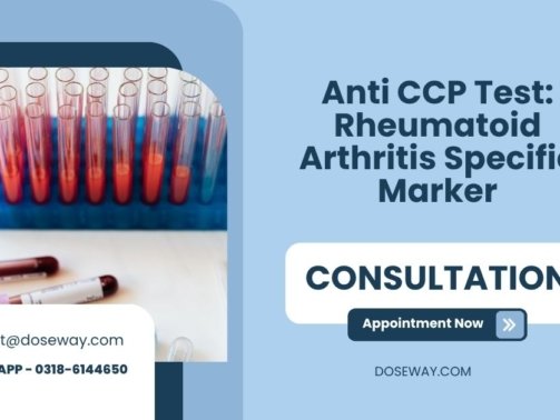 Anti-CCP-Test-Rheumatoid-Arthritis-Specific-Marker