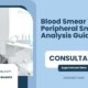 Blood-Smear-Test-Peripheral-Smear-Analysis-Guide