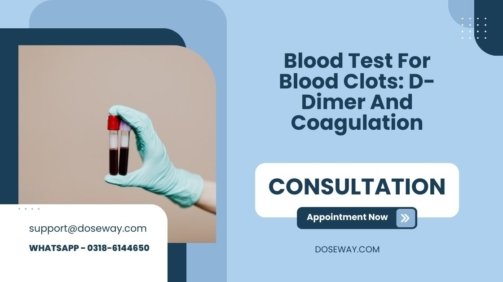 Blood-Test-For-Blood-Clots-D-Dimer-And-Coagulation
