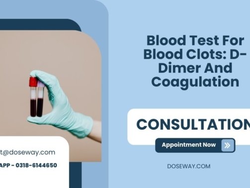 Blood-Test-For-Blood-Clots-D-Dimer-And-Coagulation