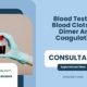 Blood-Test-For-Blood-Clots-D-Dimer-And-Coagulation
