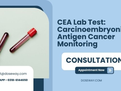 CEA-Lab-Test-Carcinoembryonic-Antigen-Cancer-Monitoring