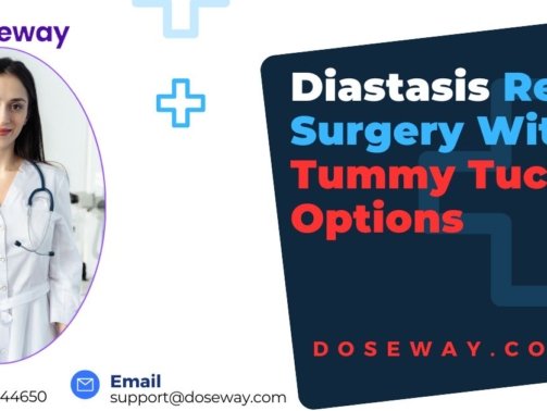 Diastasis-Recti-Surgery-Without-Tummy-Tuck
