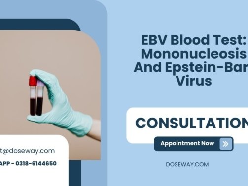 EBV-Blood-Test-Mononucleosis-And-Epstein-Barr-Virus