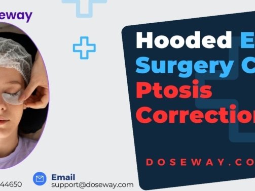 Hooded-Eye-Surgery-Cost