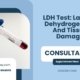 LDH-Test-Lactate-Dehydrogenase-And-Tissue-Damage