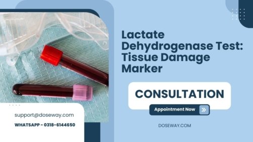 Lactate-Dehydrogenase-Test-Tissue-Damage-Marker