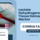 Lactate-Dehydrogenase-Test-Tissue-Damage-Marker