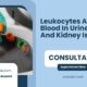 Leukocytes-And-Blood-In-Urine-UTI-And-Kidney-Issues