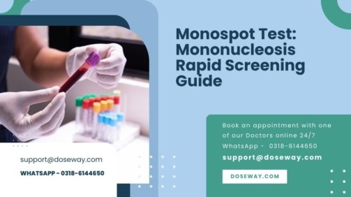 Monospot-Test-Mononucleosis-Rapid-Screening-Guide