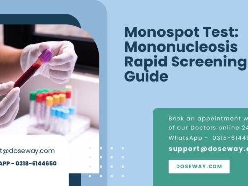 Monospot-Test-Mononucleosis-Rapid-Screening-Guide