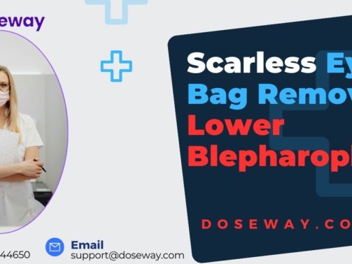 Scarless-Eye-Bag-Removal