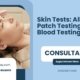 Skin-Tests-Allergy-Patch-Testing-Vs-Blood-Testing