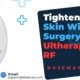 Tighten-Loose-Skin-Without-Surgery