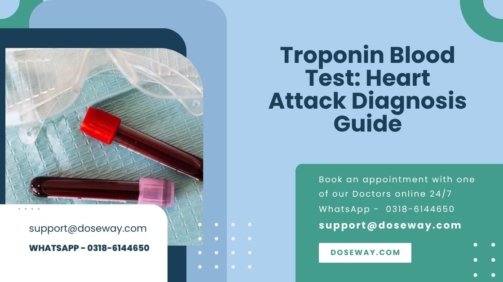 Troponin-Blood-Test-Heart-Attack-Diagnosis-Guide