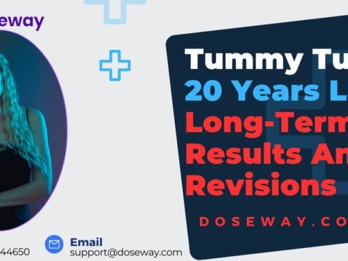 Tummy-Tuck-20-Years-Later