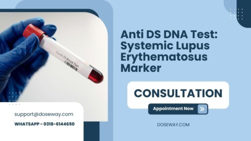 Anti-DS-DNA-Test-Systemic-Lupus-Erythematosus-Marker
