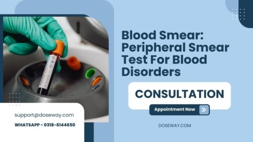 Blood-Smear-Peripheral-Smear-Test-For-Blood-Disorders