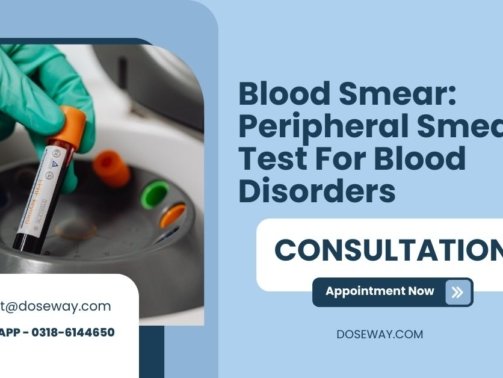 Blood-Smear-Peripheral-Smear-Test-For-Blood-Disorders