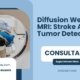 Diffusion-Weighted-MRI-Stroke-And-Tumor-Detection